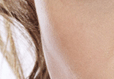 Cheek Acne Causes