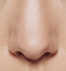 Nose Acne Causes