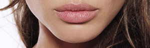 Chin Acne Causes